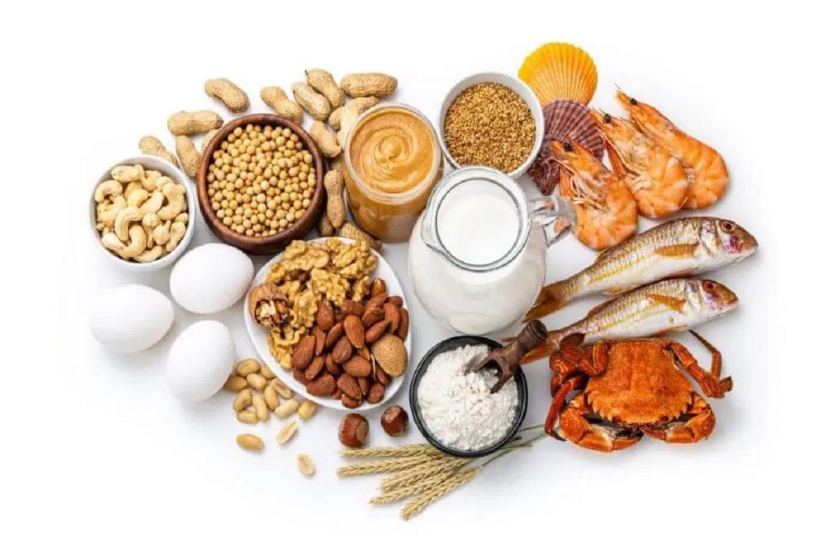Food allergies